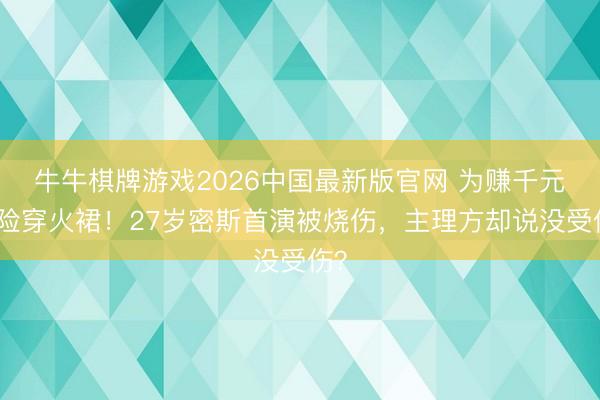 牛牛棋牌游戏2026中国最新版官网 为赚千元冒险穿火裙!27岁密斯首演被烧伤,主理方却说没受伤?